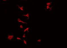 Anti-TIE2 (phospho Ser1119) antibody used in Immunocytochemistry/ Immunofluorescence (ICC/IF). GTX00793