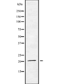 Anti-MED29 antibody used in Western Blot (WB). GTX00806