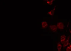 Anti-CLCN7 antibody used in Immunocytochemistry/ Immunofluorescence (ICC/IF). GTX00807