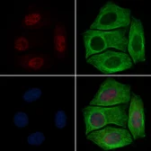 Anti-RUNX2 (phospho Ser340) antibody used in Immunocytochemistry/ Immunofluorescence (ICC/IF). GTX00812