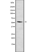 Anti-DMRTA1 antibody used in Western Blot (WB). GTX00815