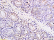 Anti-Metallothionein antibody used in IHC (Paraffin sections) (IHC-P). GTX00824