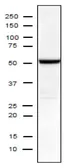 Anti-Influenza A virus Nucleoprotein antibody [C43] used in Western Blot (WB). GTX00858
