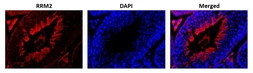 Anti-RRM2 antibody used in IHC (Paraffin sections) (IHC-P). GTX00888