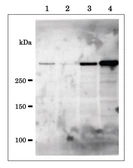 Anti-EDD antibody used in Western Blot (WB). GTX00902