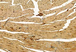 Anti-MLKL (phospho Ser358) antibody used in IHC (Paraffin sections) (IHC-P). GTX00973