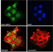 Anti-MEFV antibody used in Immunocytochemistry/ Immunofluorescence (ICC/IF). GTX01092