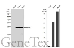 Anti-Bcl-2 antibody [GT1213] used in Western Blot (WB). GTX01194