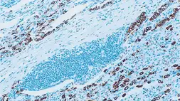 Anti-Surfactant Protein A antibody [32E12] used in IHC (Paraffin sections) (IHC-P). GTX01854