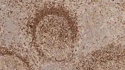 Mouse Anti-Human IgM antibody [8H6]. GTX01856