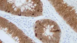 Anti-beta Catenin antibody [17C2] used in IHC (Paraffin sections) (IHC-P). GTX01865