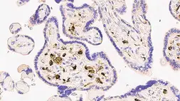 Anti-Factor XIIIa antibody [E980.1] used in IHC (Paraffin sections) (IHC-P). GTX01879