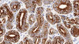 Anti-AMACR antibody [EPMU1] used in IHC (Paraffin sections) (IHC-P). GTX01883
