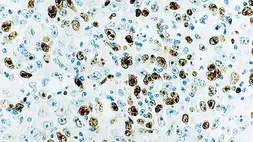 Anti-Ki67 antibody [MM1] used in IHC (Paraffin sections) (IHC-P). GTX01905