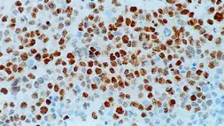 Anti-Myogenin antibody [LO26] used in IHC (Paraffin sections) (IHC-P). GTX01916
