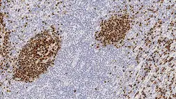 Anti-PAX5 antibody [1EW] used in IHC (Paraffin sections) (IHC-P). GTX01923