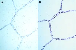 Anti-Progesterone Receptor antibody [16 + SAN27] used in IHC (Paraffin sections) (IHC-P). GTX01924