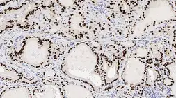 Anti-NKX2.1 antibody [SPT24] used in IHC (Paraffin sections) (IHC-P). GTX01952