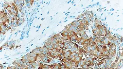 Anti-Synaptophysin antibody [27G12] used in IHC (Paraffin sections) (IHC-P). GTX01953