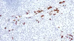 Anti-Granzyme B antibody [11F1] used in IHC (Paraffin sections) (IHC-P). GTX01962