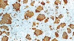 Anti-TRAP antibody [26E5] used in IHC (Paraffin sections) (IHC-P). GTX01978