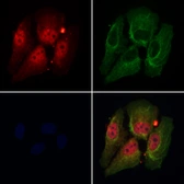 Anti-DDX17 antibody used in Immunocytochemistry/ Immunofluorescence (ICC/IF). GTX02534