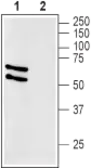 Anti-GLUT2 antibody used in Western Blot (WB). GTX02542