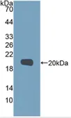 Human MMP9 protein, His tag (Active). GTX02551-pro
