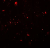 Anti-TET3 antibody used in IHC (Paraffin sections) (IHC-P). GTX02579