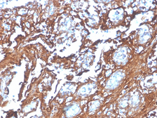 Anti-Annexin A1 antibody [rANXA1/4310] used in IHC (Paraffin sections) (IHC-P). GTX02591