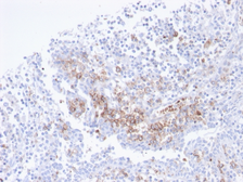 Anti-CD38 antibody [CD38/4247R] used in IHC (Paraffin sections) (IHC-P). GTX02603