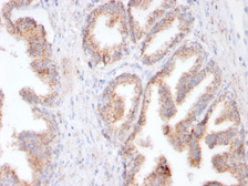 Anti-PSMA antibody [FOLH1/3149R] used in IHC (Paraffin sections) (IHC-P). GTX02639