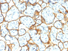 Anti-Insulin Receptor alpha antibody [INSR/2277R] used in IHC (Paraffin sections) (IHC-P). GTX02652