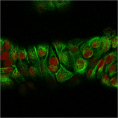 Anti-Cytokeratin 2 antibody [KRTH/2147R] used in Immunocytochemistry/ Immunofluorescence (ICC/IF). GTX02662