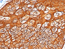 Anti-Keratin 77 antibody [KRTL/4440R] used in IHC (Paraffin sections) (IHC-P). GTX02666