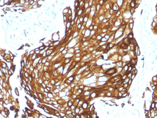 Anti-Keratin 77 antibody [KRTL/1577R] used in IHC (Paraffin sections) (IHC-P). GTX02667