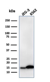 Anti-Galectin 1 antibody [GAL1/2499R] used in Western Blot (WB). GTX02670