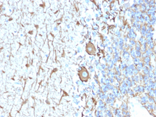 Anti-NF-H antibody [NEFL.H/2324R] used in IHC (Paraffin sections) (IHC-P). GTX02687