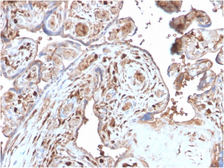 Anti-S100A4 antibody [S100A4/2750R] used in IHC (Paraffin sections) (IHC-P). GTX02703