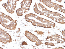 Anti-Villin antibody [rVIL1/1325] used in IHC (Paraffin sections) (IHC-P). GTX02738