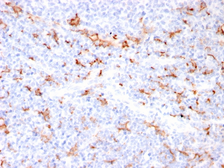 Anti-S100A8 + S100A9 antibody [MAC3157R] used in IHC (Paraffin sections) (IHC-P). GTX02753