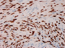 Anti-KSHV ORF73 antibody [HHV8/3606] used in IHC (Paraffin sections) (IHC-P). GTX02773