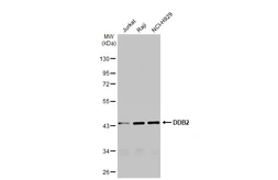 Anti-DDB2 antibody [GT1277] used in Western Blot (WB). GTX03189
