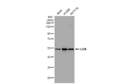 Anti-LOX antibody [GT1289] used in Western Blot (WB). GTX03201