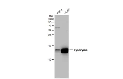 Anti-Lysozyme antibody [GT1290] used in Western Blot (WB). GTX03202