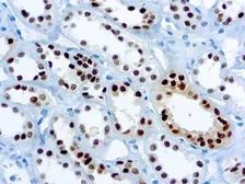 Anti-PAX8 antibody [4H7B3] used in IHC (Paraffin sections) (IHC-P). GTX03299