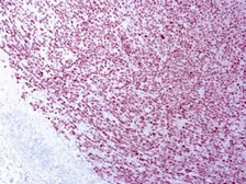 Anti-PRAME antibody [EPR20330] used in IHC (Paraffin sections) (IHC-P). GTX03315