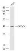 Anti-SPOCK1 antibody used in Western Blot (WB). GTX03362
