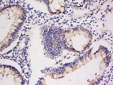 Anti-Integrin alpha V + beta 5 antibody used in IHC (Paraffin sections) (IHC-P). GTX03382