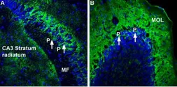 Anti-Sodium/Potassium ATPase alpha 2 antibody used in IHC (Frozen sections) (IHC-Fr). GTX03457